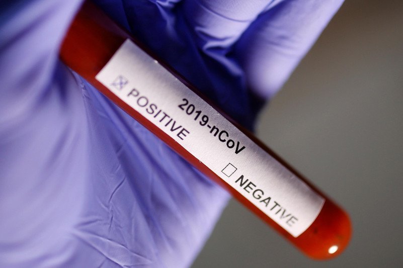 Қазақстанда коронавирус анықталған адам саны 2025 болды