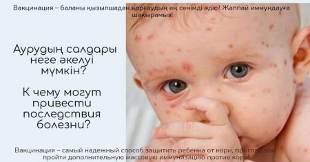 Қызылша: себептері, инфекция жолдары, белгілері, емі және балалардағы аурудың алдын алу
