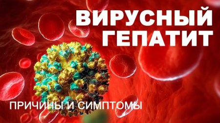 Вирусты гепатит дегеніміз не?