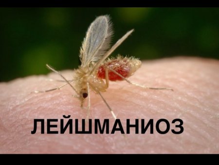 Висцеральды лейшманиоз